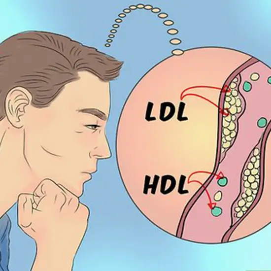 cholesterol ratio: total/hdl (high-density lipoprotein) test